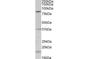Western Blotting (WB) image for anti-Potassium Voltage-Gated Channel, Shaw-Related Subfamily, Member 3 (KCNC3) (Internal Region) antibody (ABIN2465018) (KCNC3 Antikörper  (Internal Region))