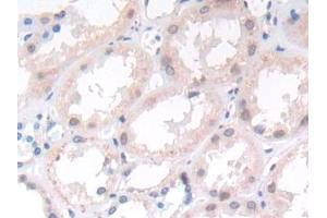 DAB staining on IHC-P; Samples: Human Kidney Tissue (APLP2 Antikörper  (AA 607-852))