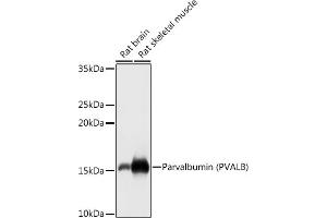 Western blot analysis of extracts of various cell lines, using Parvalbumin (PVALB) antibody (ABIN6128526, ABIN6146506, ABIN6146507 and ABIN6217573) at 1:1000 dilution. (PVALB Antikörper  (AA 1-110))