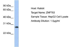 Host: Rabbit Target Name: ZNF763 Sample Type: HepG2 Whole cell lysates Antibody Dilution: 1. (ZNF763 Antikörper  (C-Term))