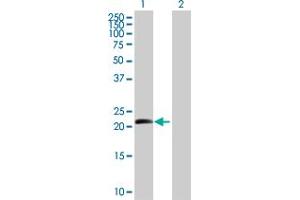 Western Blot analysis of BTC expression in transfected 293T cell line by BTC MaxPab polyclonal antibody. (Betacellulin Antikörper  (AA 1-178))