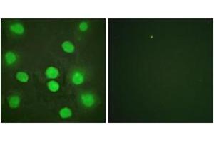 Immunofluorescence analysis of HuvEc cells, using GATA4 (Ab-262) Antibody. (GATA4 Antikörper  (AA 228-277))