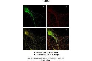 Sample Type :  Rat Hippocampal Neurons - 14DIV  Primary Antibody Dilution :  1:200  Secondary Antibody :  Anti-rabbit-Cy3  Secondary Antibody Dilution :  1:500  Color/Signal Descriptions :  Green: GFP Red: NR2a Yellow: VGLUT12  Gene Name :  GRIN2A  Submitted by :  Dan Fowler - University of Oregon, Institute of Neuroscience