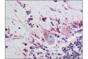 Immunohistochemistry (IHC) image for anti-Cathepsin D (CTSD) (AA 21-412) antibody (ABIN317502) (Cathepsin D Antikörper  (AA 21-412))