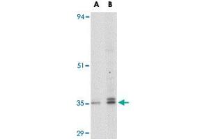 Western blot analysis of GPR3 in EL4 cell lysate with GPR3 polyclonal antibody  at (A) 1 and (B) 2 ug/mL . (GPR3 Antikörper  (C-Term))