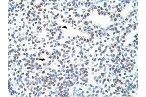 POGZ antibody was used for immunohistochemistry at a concentration of 4-8 ug/ml to stain Alveolar cells (arrows) in Human Lung. (POGZ Antikörper  (N-Term))