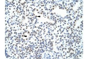 POGZ antibody was used for immunohistochemistry at a concentration of 4-8 ug/ml to stain Alveolar cells (arrows) in Human Lung.