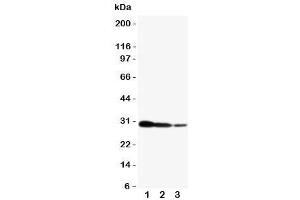 Western blot testing of CRTC2 antibody and human recombinant protein, 29KD with tag