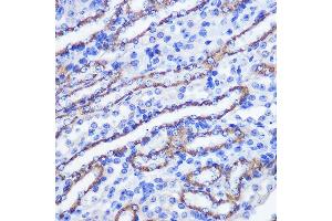 Immunohistochemistry of paraffin-embedded mouse kidney using PHLPP1 Rabbit pAb (ABIN6128434, ABIN6145573, ABIN6145574 and ABIN6225035) at dilution of 1:100 (40x lens). (PHLPP1 Antikörper  (AA 1508-1717))