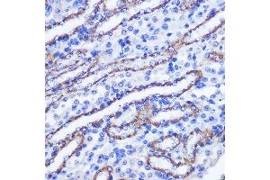 Immunohistochemistry of paraffin-embedded mouse kidney using PHLPP1 Rabbit pAb (ABIN6128434, ABIN6145573, ABIN6145574 and ABIN6225035) at dilution of 1:100 (40x lens).
