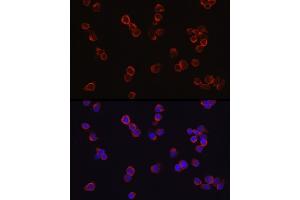 Immunofluorescence analysis of Jurkat cells using CD4 Rabbit pAb (ABIN3022124, ABIN3022125, ABIN3022126 and ABIN6218611) at dilution of 1:100 (40x lens).