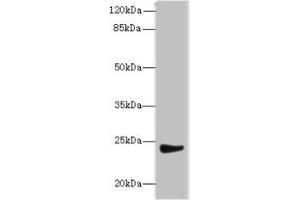 Western blot All lanes: MRPL22 antibody at 12 μg/mL + SH-SY5Y whole cell lysate Secondary Goat polyclonal to rabbit IgG at 1/10000 dilution Predicted band size: 24, 14, 15 kDa Observed band size: 24 kDa (MRPL22 Antikörper  (AA 41-206))