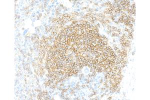 Immunohistochemistry (IHC) image for anti-CD19 Molecule (CD19) (AA 19-287) antibody (ABIN7455123)
