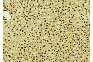 ABIN6276988 at 1/100 staining Mouse liver tissue by IHC-P. (NR1I3 Antikörper  (Internal Region))