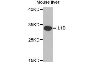 Western Blotting (WB) image for anti-Interleukin 1, beta (IL1B) (AA 1-269) antibody (ABIN3021462) (IL-1 beta Antikörper  (AA 1-269))