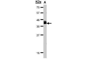 Western Blotting (WB) image for anti-B-Cell CLL/lymphoma 7A (BCL7A) (C-Term) antibody (ABIN2854648)