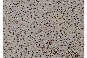 ABIN6273137 at 1/100 staining Mouse liver tissue by IHC-P. (MECP2 Antikörper  (C-Term))
