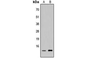 Western blot analysis of p311 expression in HEK293T (A), H9C2 (B) whole cell lysates. (NREP Antikörper  (Center))