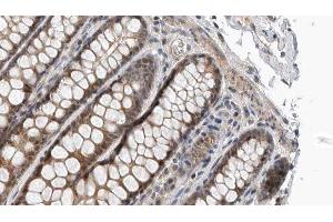 ABIN6276986 at 1/100 staining Rat colon tissue by IHC-P.