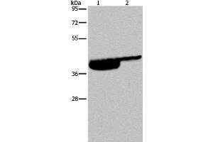 Western Blot analysis of Human bladder and bladder transitional cell carcinoma tissue using P2RX3 Polyclonal Antibody at dilution of 1:250 (P2RX3 Antikörper)