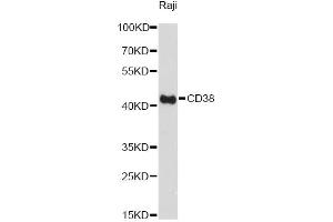 Western blot analysis of extracts of Raji cells, using CD38 Antibody.