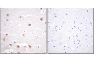 Immunohistochemistry (IHC) image for anti-Casein Kinase 2, beta (CSNK2B) (AA 166-215) antibody (ABIN2888808) (CSNK2B Antikörper  (AA 166-215))