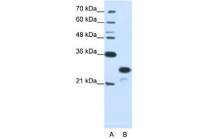 ANP32A antibody used at 1. (PHAP1 Antikörper)