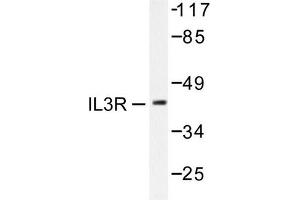 Image no. 2 for anti-Interleukin 3 Receptor, alpha (IL3RA) antibody (ABIN265478) (IL3RA Antikörper)