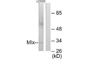 Western blot analysis of extracts from LOVO cells, using Mlx antibody. (MLX Antikörper  (Internal Region))