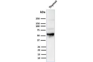 Western Blot Analysis of human Thymus tissue lysate using Cytokeratin 10 Mouse Monoclonal Antibody (LH2). (Keratin 10 Antikörper)