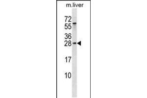 Western blot analysis in mouse liver tissue lysates (35ug/lane). (RAB5B Antikörper  (AA 85-112))