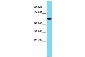 Host: Rabbit  Target Name: Gpatc2  Sample Tissue: Rat Spleen lysates  Antibody Dilution: 1. (GPATCH2 Antikörper  (C-Term))