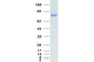 Western Blotting (WB) image for Disabled Homolog 2, Mitogen-Responsive phosphoprotein (Drosophila) (DAB2) protein (Myc-DYKDDDDK Tag) (ABIN2712271)