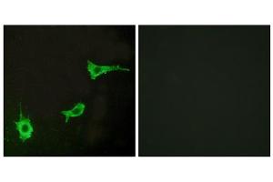 Immunofluorescence analysis of LOVO cells, using ADRA1B antibody. (ADRA1B Antikörper  (C-Term))