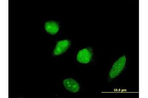 Immunofluorescence of monoclonal antibody to SCML2 on HeLa cell.