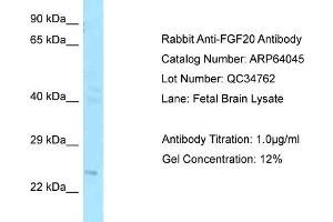Western Blotting (WB) image for anti-Fibroblast Growth Factor 20 (FGF20) (C-Term) antibody (ABIN2789708) (FGF20 Antikörper  (C-Term))