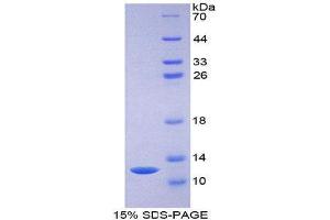 SDS-PAGE (SDS) image for Chemokine (C-C Motif) Ligand 7 (CCL7) (AA 24-97) protein (His tag) (ABIN2125947)