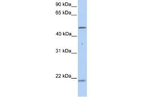WB Suggested Anti-KRT10 Antibody Titration:  0. (Keratin 10 Antikörper  (N-Term))