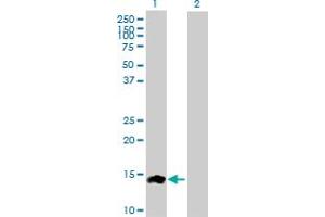Western Blot analysis of CCL24 expression in transfected 293T cell line by CCL24 MaxPab polyclonal antibody. (CCL24 Antikörper  (AA 1-119))