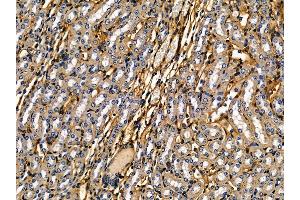 ABIN7095283 and ABIN7099340 at 1/100 staining mouse kidney tissue by IHC-P. (IFT74 Antikörper)