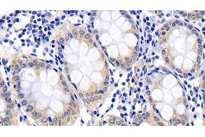 Immunohistochemistry (IHC) image for anti-Caspase 8 (CASP8) (AA 385-479) antibody (ABIN7437074)