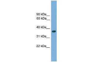 WB Suggested Anti-Hoxa1 Antibody Titration:  0. (HOXA1 Antikörper  (C-Term))