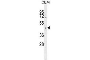 CCDC122 Antibody (C-term) western blot analysis in CEM cell line lysates (35µg/lane). (CCDC122 Antikörper  (C-Term))