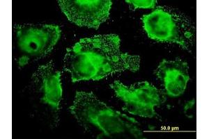 Image no. 1 for anti-Mitochondrial Ribosomal Protein L12 (MRPL12) (AA 1-199) antibody (ABIN598585) (MRPL12 Antikörper  (AA 1-199))