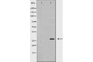 Western blot analysis of K562 whole cell lysates, using HLA-DQA1 Antibody.