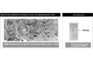 Immunohistochemistry (IHC) image for anti-Matrix Metallopeptidase 3 (Stromelysin 1, Progelatinase) (MMP3) (C-Term) antibody (ABIN264506) (MMP3 Antikörper  (C-Term))