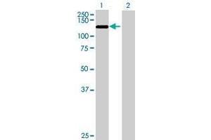 Western Blotting (WB) image for TET3 293T Cell Transient Overexpression Lysate(Denatured) (ABIN1339083)