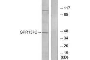 Western blot analysis of extracts from HepG2 cells, using GPR137C Antibody. (GPR137C Antikörper  (AA 256-305))