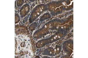 Immunohistochemical staining of human colon with ERGIC1 polyclonal antibody  shows strong cytoplasmic and membranous positivity in glandular cells at 1:20-1:50 dilution. (ERGIC1 Antikörper)