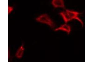 ABIN6269122 staining NIH-3T3 by IF/ICC. (c-MET Antikörper  (C-Term))